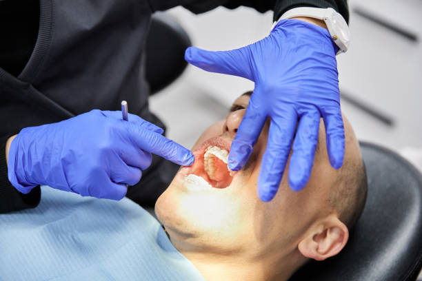 Best Emergency Treatment for Dental Infections or Abscesses in Roswell, GA